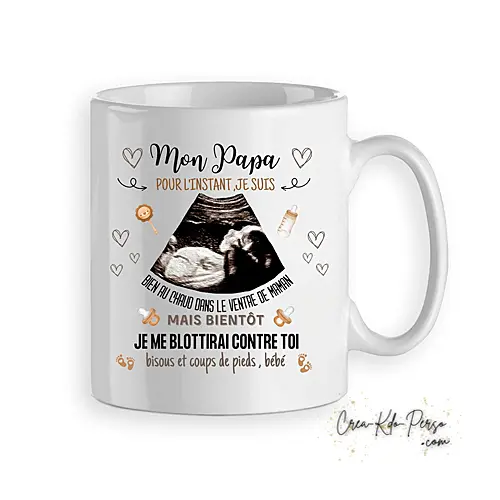 Mug Personnalisé avec Échographie – Cadeau Inoubliable pour Futur Papa